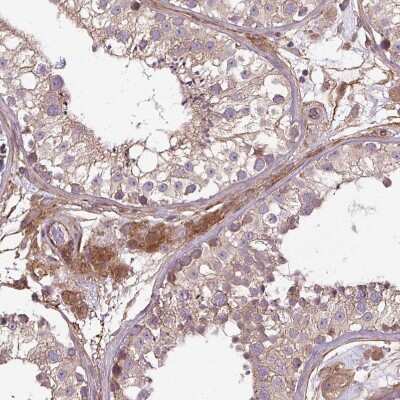 Immunohistochemistry-Paraffin: CCDC93 Antibody [NBP2-30369]