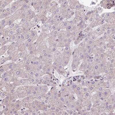 Immunohistochemistry-Paraffin: CCDC93 Antibody [NBP2-30369]