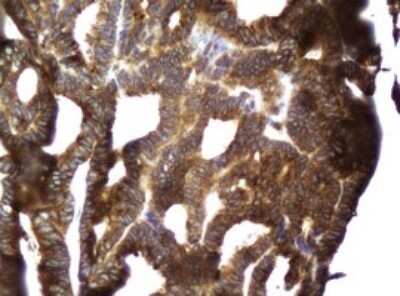 Immunohistochemistry: CCDC93 Antibody (OTI6E11) - Azide and BSA Free [NBP2-71963]
