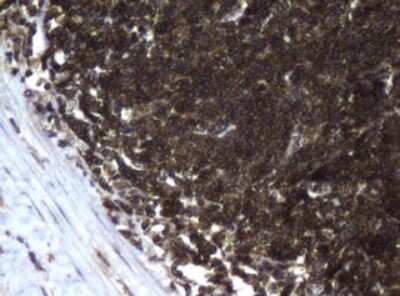 Immunohistochemistry: CCDC93 Antibody (OTI6E11) - Azide and BSA Free [NBP2-71963]