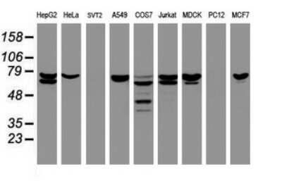 Western Blot: CCDC93 Antibody (OTI6E11)Azide and BSA Free [NBP2-71963]