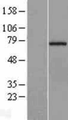 Western Blot: CCDC93 Overexpression Lysate [NBL1-08832]