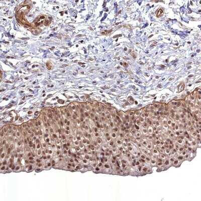 Immunohistochemistry-Paraffin: CCDC94 Antibody [NBP1-91766]