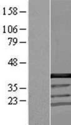 Western Blot: CCDC94 Overexpression Lysate [NBL1-08833]