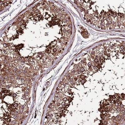 Immunohistochemistry-Paraffin: CCDC96 Antibody [NBP2-14458]
