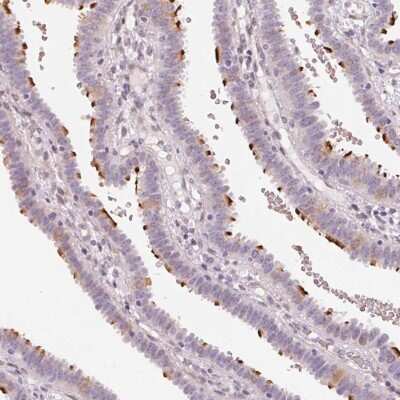 Immunohistochemistry-Paraffin: CCDC96 Antibody [NBP2-14458]