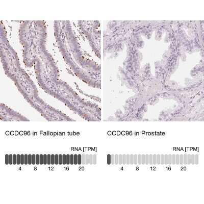 Immunohistochemistry-Paraffin: CCDC96 Antibody [NBP2-14458]