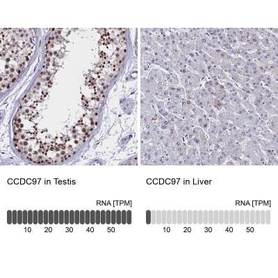 Immunohistochemistry-Paraffin: CCDC97 Antibody [NBP1-91768]