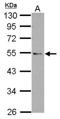 Western Blot: CCDC97 Antibody [NBP2-15758]