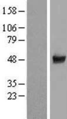 Western Blot: CCDC97 Overexpression Lysate [NBL1-08835]