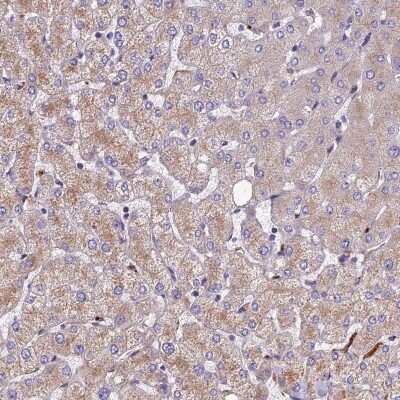 Immunohistochemistry-Paraffin: CCDC99 Antibody [NBP2-47517]