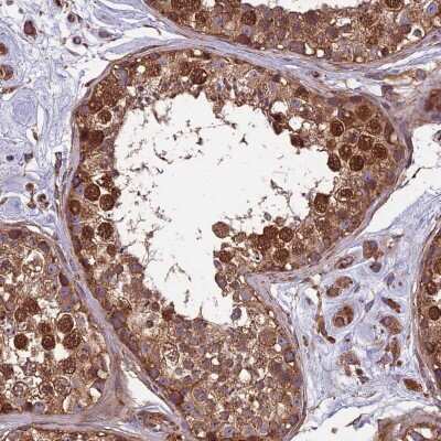 Immunohistochemistry-Paraffin: CCDC99 Antibody [NBP2-47517]