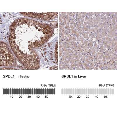 Immunohistochemistry-Paraffin: CCDC99 Antibody [NBP2-47517]