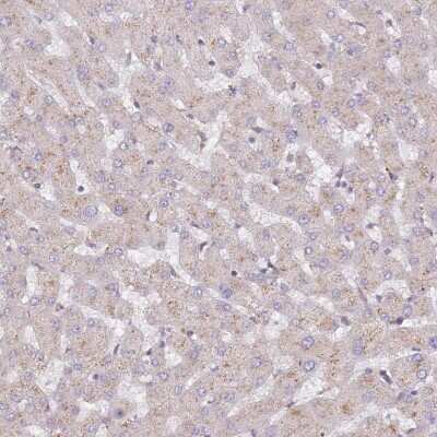 Immunohistochemistry-Paraffin: CCDC99 Antibody [NBP2-47518]
