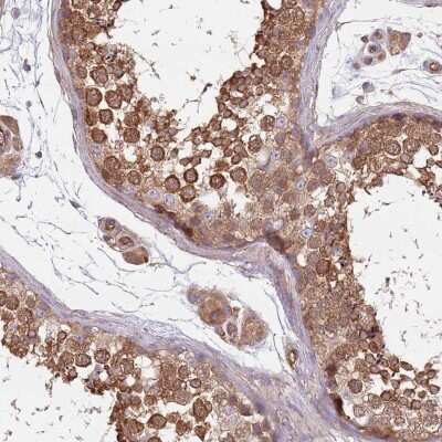 Immunohistochemistry-Paraffin: CCDC99 Antibody [NBP2-47518]