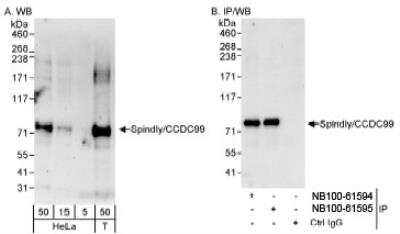 Western Blot: CCDC99 Antibody [NB100-61594]