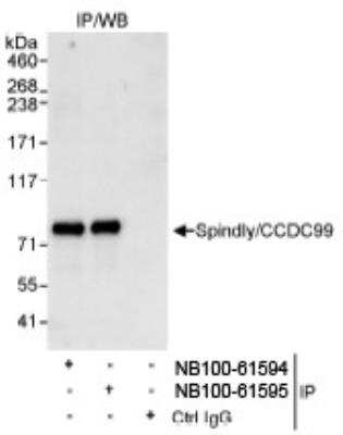 Western Blot: CCDC99 Antibody [NB100-61595]