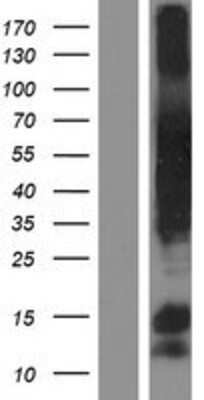 Western Blot: CCDC99 Overexpression Lysate [NBP2-06925]