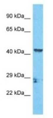 Western Blot: CCHC-type Zinc Finger Antibody [NBP3-09928]