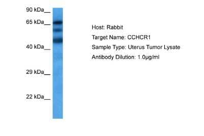 Western Blot: CCHCR1 Antibody [NBP2-82633]