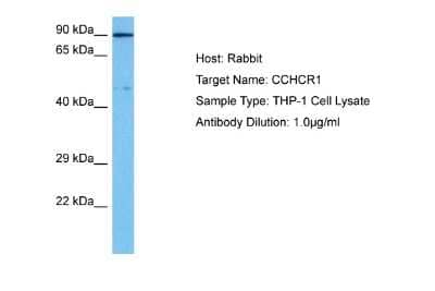 Western Blot: CCHCR1 Antibody [NBP2-82634]