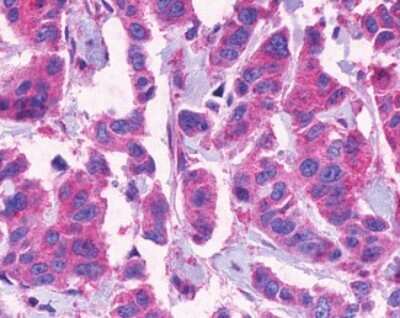 Immunohistochemistry-Paraffin: CCK-AR Antibody - BSA Free [NLS3293]