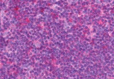 Immunohistochemistry-Paraffin: CCK-AR Antibody - BSA Free [NLS3293]