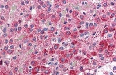 Immunohistochemistry-Paraffin: CCK-AR Antibody [NBP3-14558]