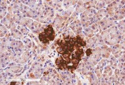 Immunohistochemistry-Paraffin: CCK-AR Antibody [NB100-2805]