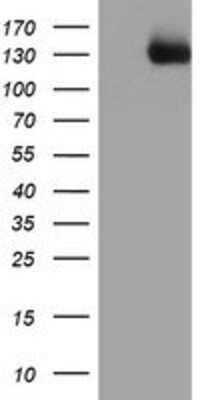 Western Blot: PTK7/CCK4 Antibody (OTI2E7) [NBP2-01486]