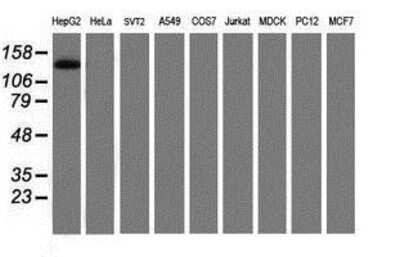 Western Blot: PTK7/CCK4 Antibody (OTI2E7) [NBP2-01486]