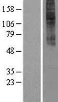 Western Blot: CCK-AR Overexpression Lysate [NBL1-08839]