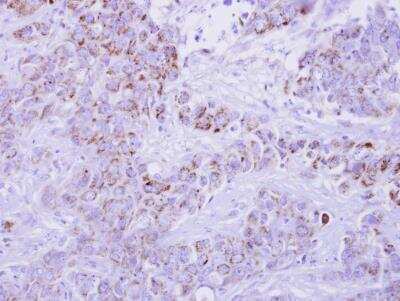 Immunohistochemistry-Paraffin: CCL1/I-309/TCA-3 Antibody [NBP1-31182]