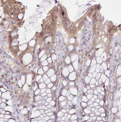 Immunohistochemistry-Paraffin: CCL1/I-309/TCA-3 Antibody [NBP2-14459]