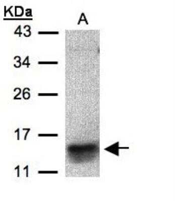 Western Blot: CCL1/I-309/TCA-3 Antibody [NBP1-31182]