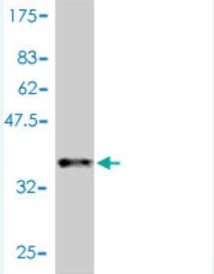 Western Blot: CCL11/Eotaxin Antibody (1C8-2C1) [H00006356-M01]