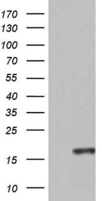 Western Blot: CCL11/Eotaxin Antibody (OTI2H9) [NBP2-46081]