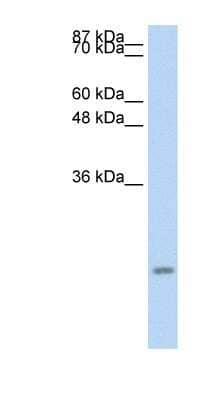 Western Blot: CCL13/MCP-4 Antibody [NBP1-79936]