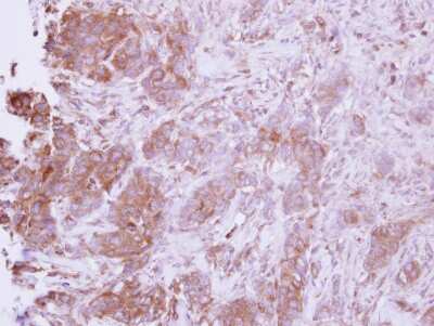 Immunohistochemistry-Paraffin: CCL14/HCC-1/HCC-3 Antibody [NBP2-15760]