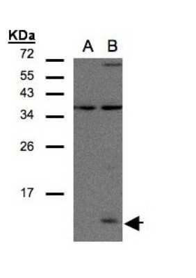 Western Blot: CCL14/HCC-1/HCC-3 Antibody [NBP2-15760]