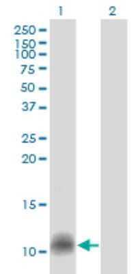 Western Blot: CCL14/HCC-1/HCC-3 Antibody (1F12) [H00006358-M01]