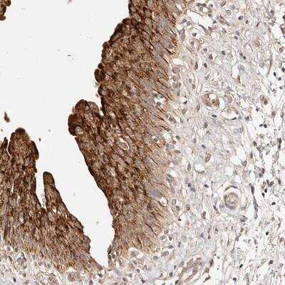 Immunohistochemistry-Paraffin: CCL14/HCC-1/HCC-3 Antibody [NBP1-85595]