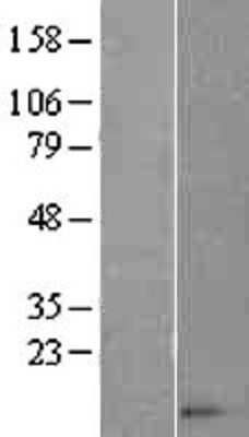 Western Blot: CCL14/HCC-1/HCC-3 Overexpression Lysate [NBL1-08844]