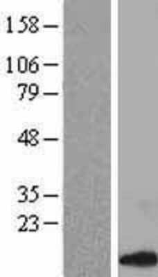 Western Blot: CCL14/HCC-1/HCC-3 Overexpression Lysate [NBL1-08845]