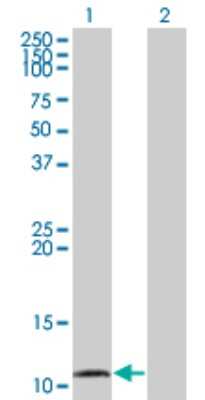 Western Blot: CCL15/MIP-1 delta Antibody (1D7) [H00006359-M01]