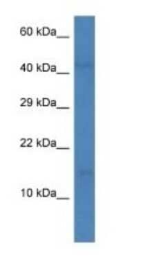 Western Blot: CCL16/HCC-4/LEC Antibody [NBP1-74186]