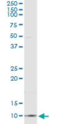 Immunoprecipitation: CCL18/PARC Antibody (2C6) [H00006362-M03]