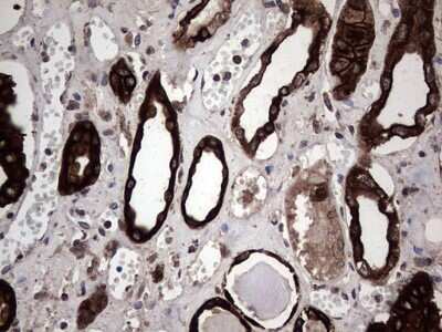 Immunohistochemistry: CCL19/MIP-3 beta Antibody (OTI2A12) [NBP2-46082]