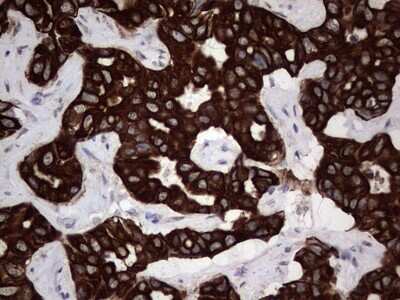 Immunohistochemistry: CCL19/MIP-3 beta Antibody (OTI2A12) [NBP2-46082]