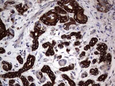 Immunohistochemistry: CCL19/MIP-3 beta Antibody (OTI2A12) [NBP2-46082]